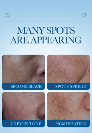 Sérum Antiedad Blanqueante con Colágeno (40ml)